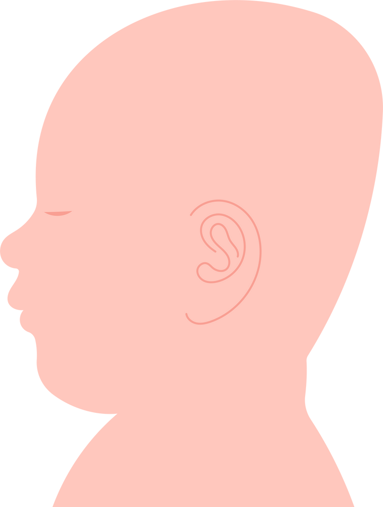 Flat Head Syndrome sleeping shape anterior